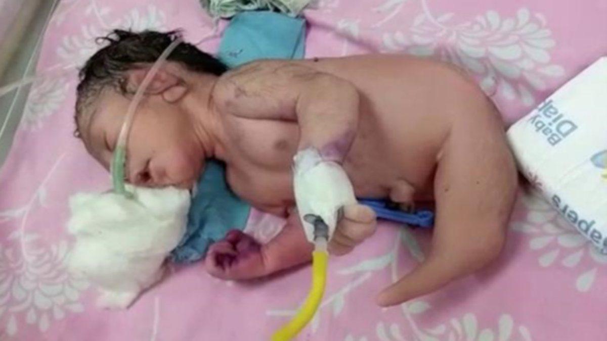 Hindistan’da belden aşağısı boynuzla doğan bebek şaşırttı