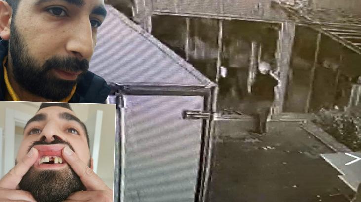 Silivri’de öldüresiye dayak! Dişleri döküldü