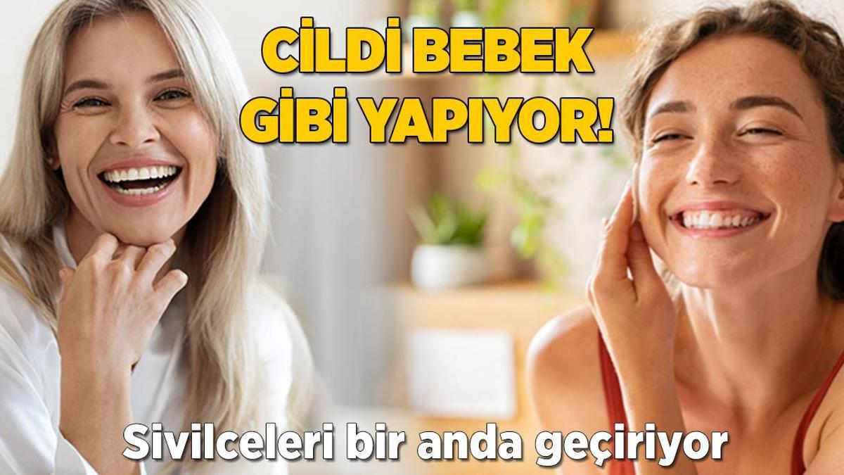 Cildi bebek gibi yapan mucize! Hem sakinleştiriyor hem de yatıştırıyormuş
