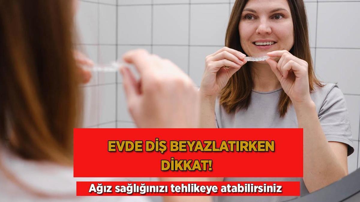 Evde diş beyazlatırken dikkat! Ağız sağlığınızı tehlikeye atabilirsiniz