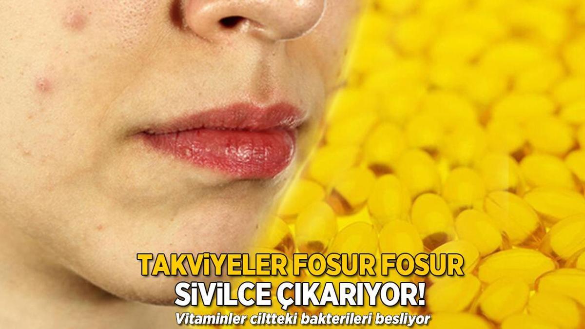 Vitamin de ne yapar demeyin! Sivilceler bir anda bastırıyor, ellerimizle besliyoruz