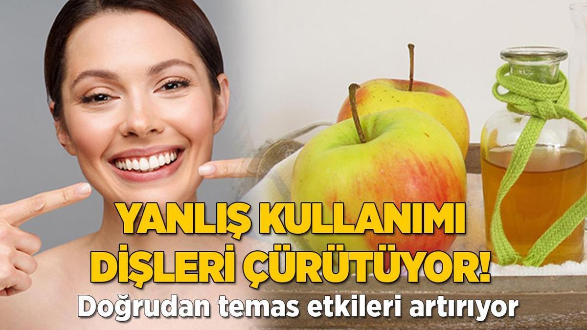 Yanlış kullanımı dişleri çürütüyor! Bu ürünü temas ettirmeyin